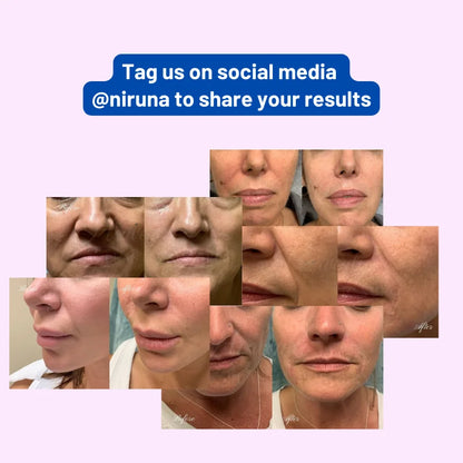 Niruna™ Laugh Line Mask